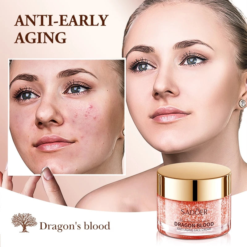 SADOER Retinol Dragon Blood Cream Whitening Moisturizing Anti Aging Cream Melasma Acne Freckles Remover 50g Beauty Express Hub