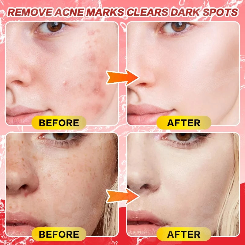 Alpha Arbutin Body Serum for Skin Whitening Skin Care Essence Moisturizer 500ml