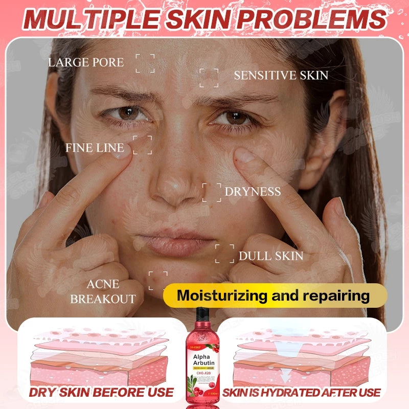 Alpha Arbutin Body Serum for Skin Whitening Skin Care Essence Moisturizer 500ml