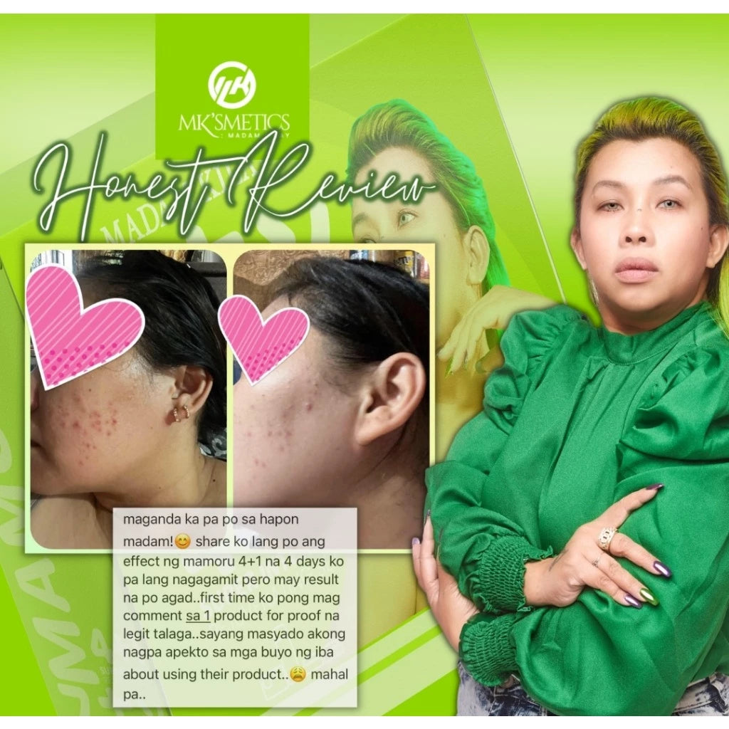 MK'SMETICS MAMORU by Madam Kilay 4+1 Super Intense Rejuvenating Set Peeling Whitening