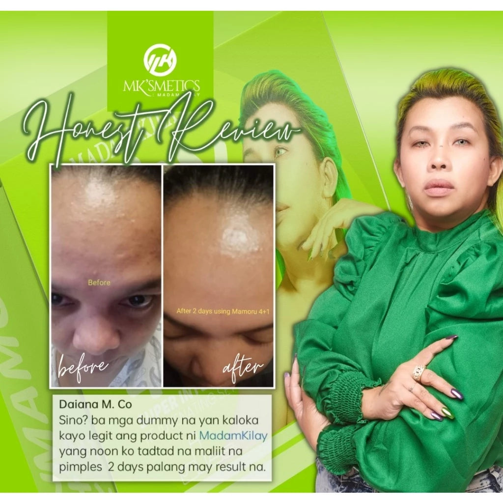 MK'SMETICS MAMORU by Madam Kilay 4+1 Super Intense Rejuvenating Set Peeling Whitening